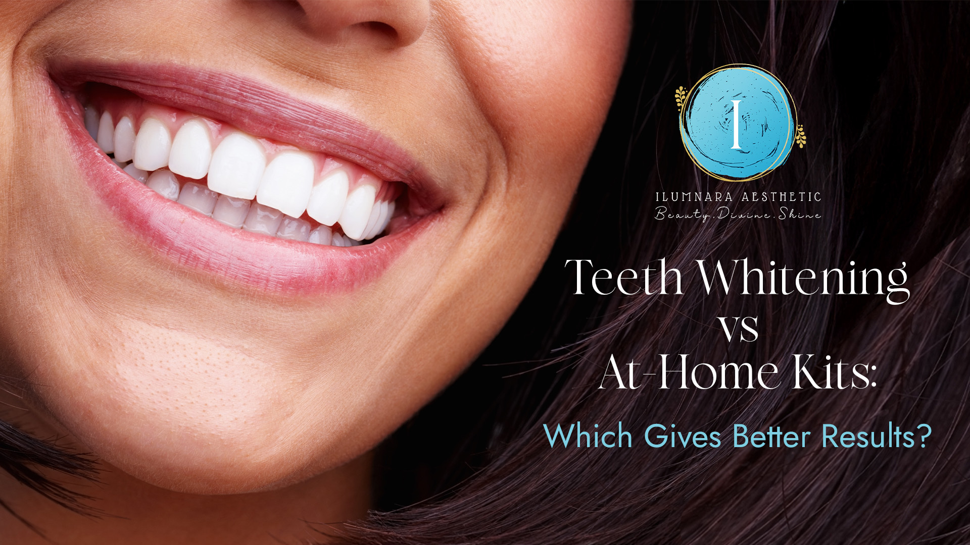 Teeth Whitening vs At-Home Kits, Which Gives Better Results?